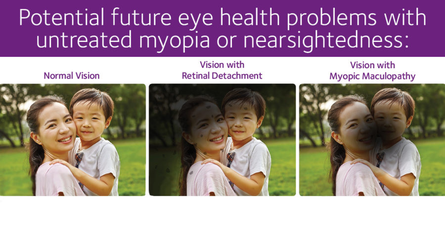 Myopia Sm Post Images 1200 X 630 Pixels 3 1 900x500