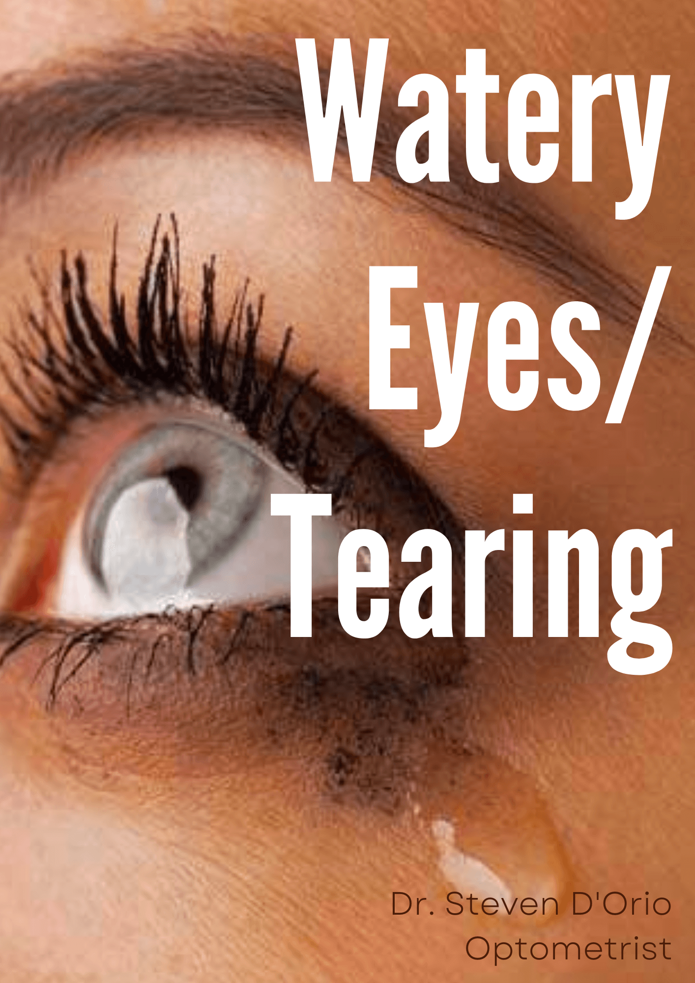 Watery Eyes Tearing