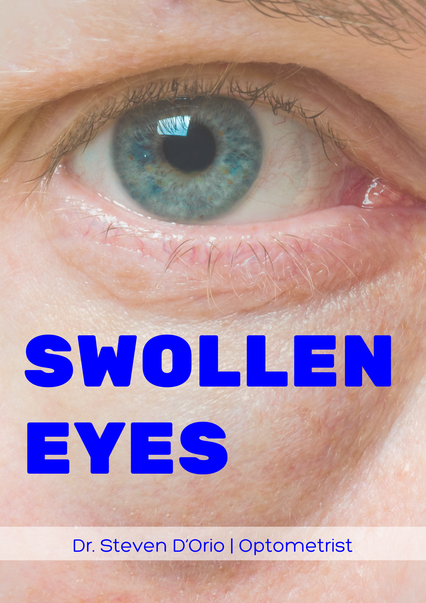 Swollen Eyes