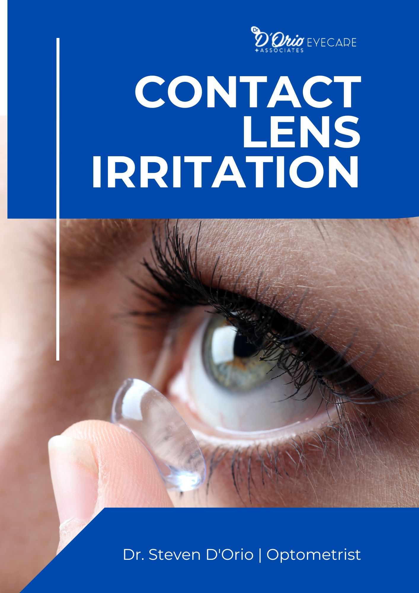 Contact Lens Irritation Ebook