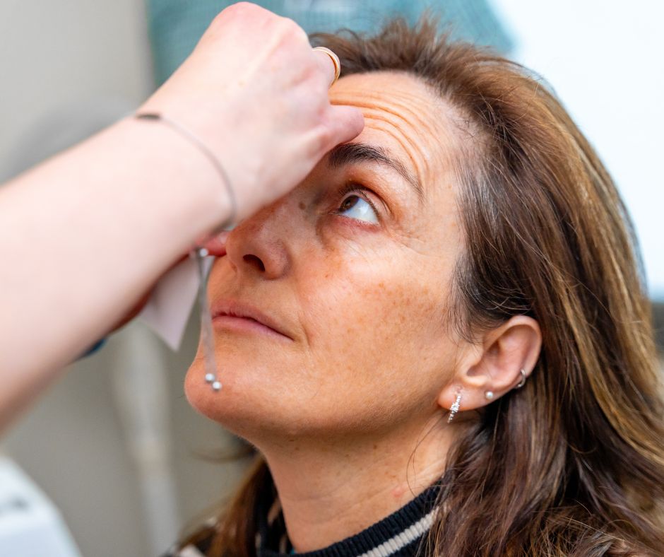 Thyroid Eye Disease thyroid eye disease
